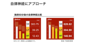 寝屋川市の腸もみサロンReiでの施術前後における自律神経バランスの測定結果データ。